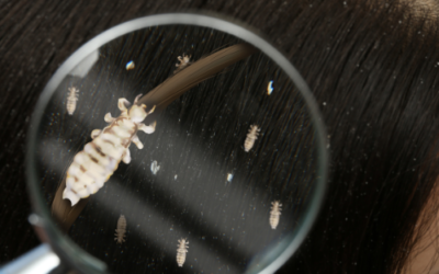 CENTRE ANTI-POUX VILLEFRANCHE-SUR-SAÔNE : DITES ADIEU AUX POUX AVEC LA CLINIQUE DU POUX LYON