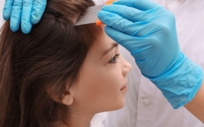 POUX LYON : LE CENTRE ANTI-POUX LYON LE MOINS CHER ET 100% NATUREL