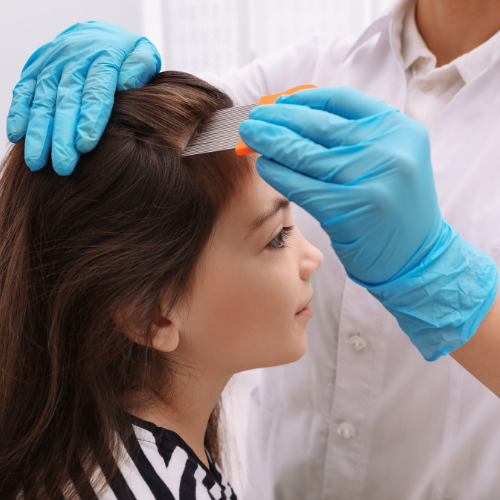 POUX LYON : LE CENTRE ANTI-POUX LYON LE MOINS CHER ET 100% NATUREL